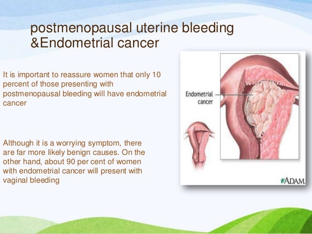 bleeding menopausal post vaginal Bleeding menopausal post vaginal